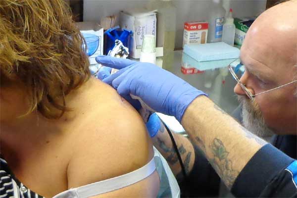 Tattooing hurts, Pain and Tattoo, Avoid pain, Skin Conditions