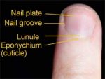 Fingernail Cuticle Care - Cuticle Infection, Paronychia, Care Cuticles ...